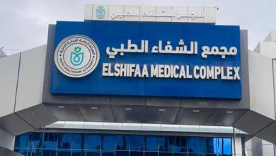 نجاح استئصال ورم ضخم يزيد حجمه عن 10 سم بمنطقة الحوض "بدون جراحة" بمجمع الشفاء الطبي التابع لهيئة الرعاية الصحية ببورسعيد