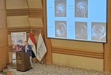 800 طبيب من 85 دولة في المؤتمر الـ52 للجمعية الدولية لجراحة أعصاب الأطفال
