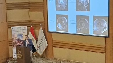 800 طبيب من 85 دولة في المؤتمر الـ52 للجمعية الدولية لجراحة أعصاب الأطفال